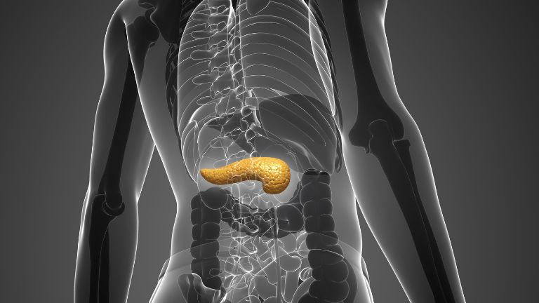 Cistos do pâncreas - Imagem Ilustrativa