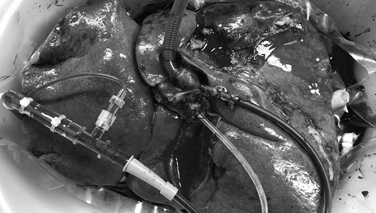 Inovação – A preservação dinâmica de órgãos através da máquina de perfusão hepática ex situ - banner